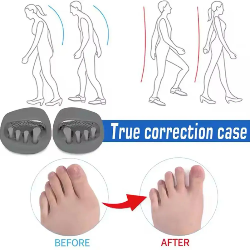 Leg Correction Slippers Scient - Home Improvement Man recension och pris